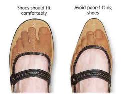 Problems caused by tight shoes